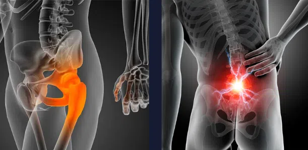 Movilidad de Cadera: Solución para el Dolor Lumbar